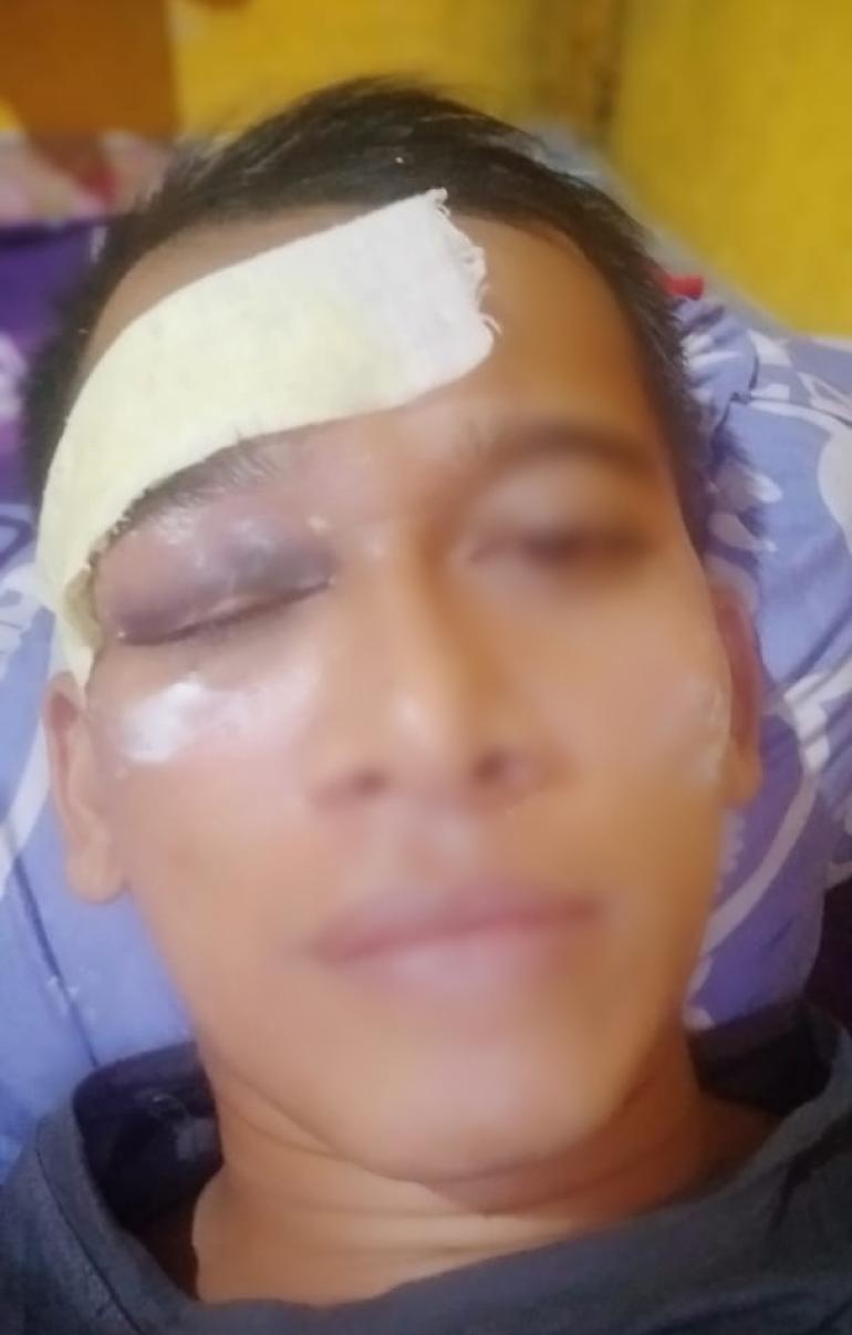 Jurnalis Media Online Babak Belur Dianiaya Oknum Ketua Ormas